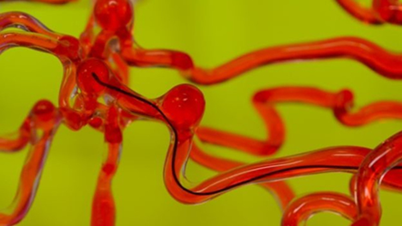 麻省理工開(kāi)發(fā)磁控線性機(jī)器人，能在腦血管中自由穿梭